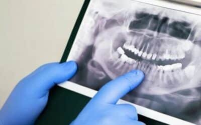 Scientists Identify Stem Cells That Could Regrow Teeth and Jawbone