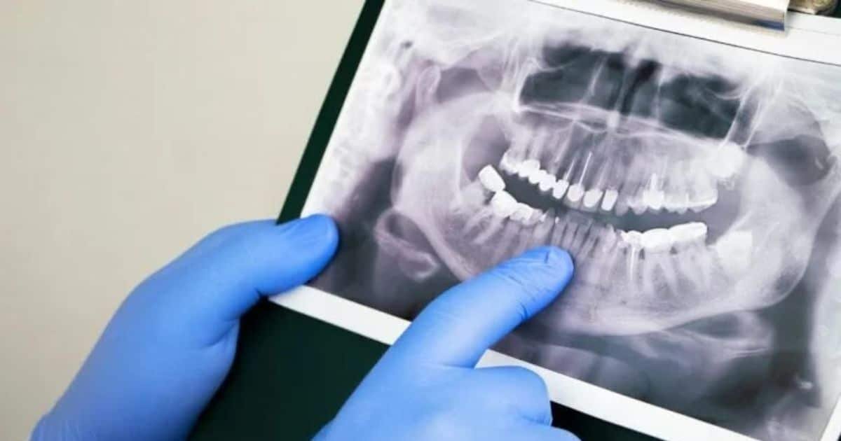 Scientists Identify Stem Cells That Could Regrow Teeth and Jawbone Scientists Identify Stem Cells That Could Regrow Teeth and Jawbone