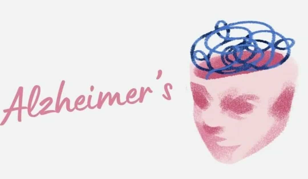 Study Finds Men’s Brains Age Faster But Women Still Face Greater Alzheimer’s Risk