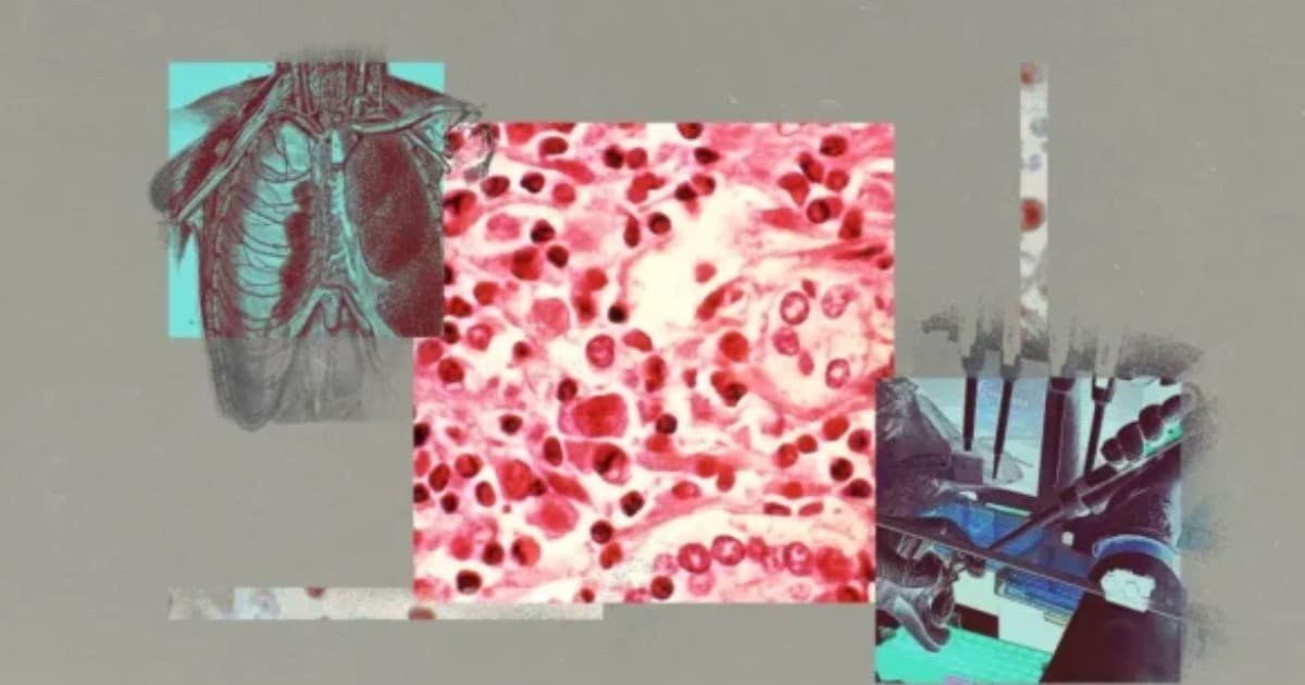Hantavirus What You Need To Know Hantavirus What You Need To Know